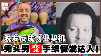 脱发反成创业契机 秃头男变手织假发达人！