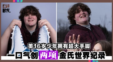 美16岁少年拥有超大手脚 一口气创两项金氏世界纪录