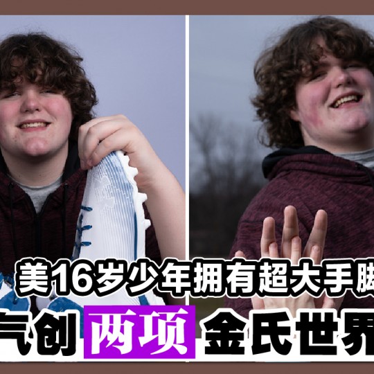 美16岁少年拥有超大手脚 一口气创两项金氏世界纪录