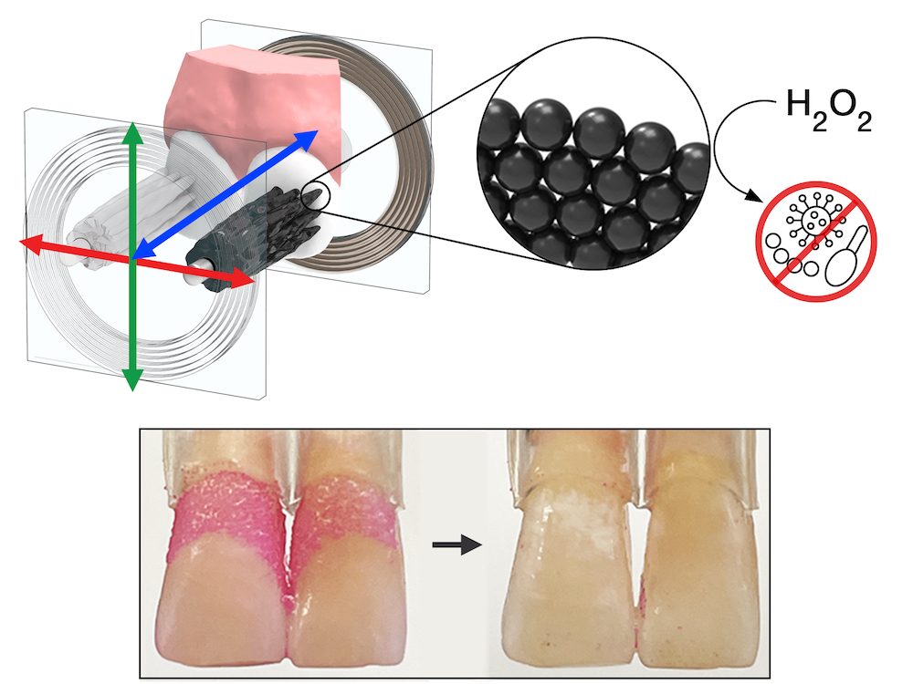 Koo-Steager-microswarm-dental-main